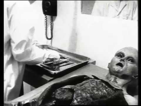 Alien autopsy – Roswell UFO Crash, 1947