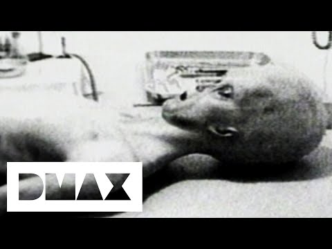 Video Footage Of An Alien Autopsy Sheds Light Over UFO Mystery | World's Strangest UFO Stories